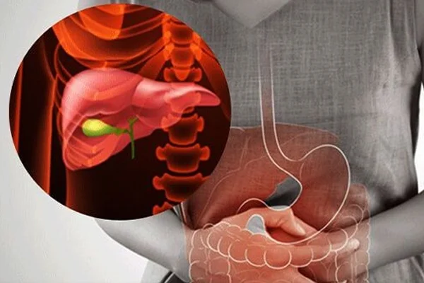 Gall Bladder Cancer