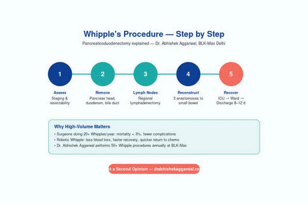 Whipples Procedure