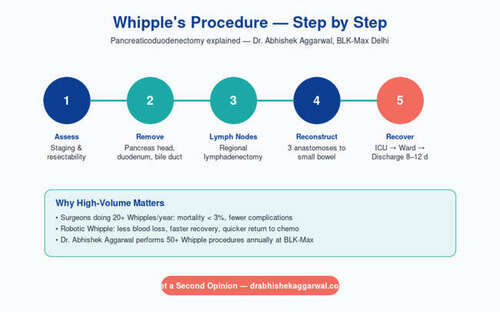 Whipple Surgery Explained Procedure Recovery and Success Rate