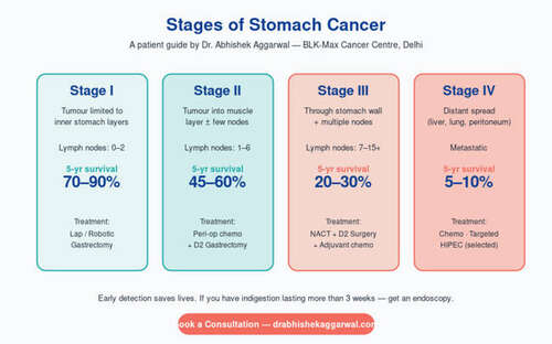 Stomach Cancer 7 Early Warning Signs Every Indian Should Know
